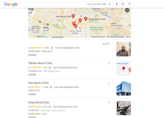 ثبت کلینیک کاشت مو در گوگل مپ